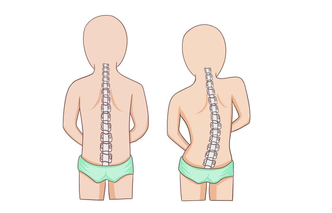 怎么自测乳腺堵没堵_假胯宽怎么坐可以矫正_