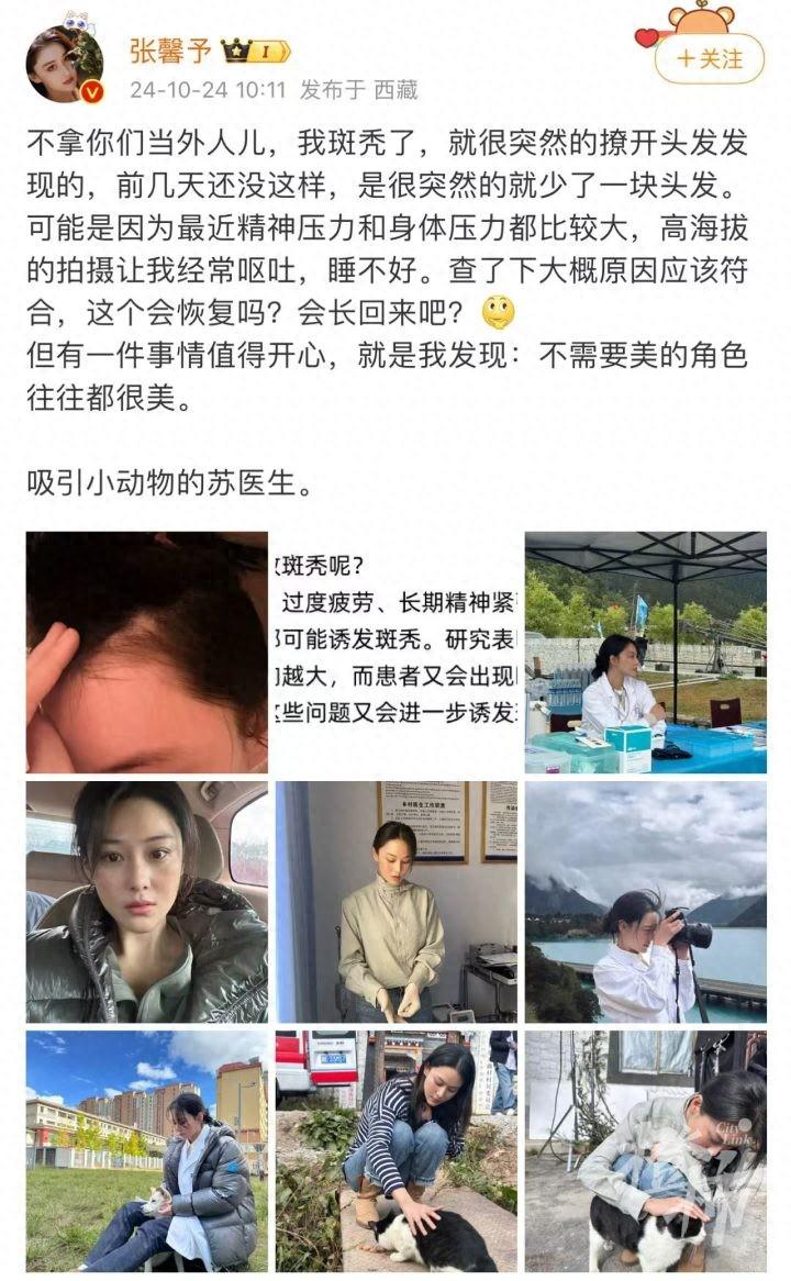 知名女演员自爆“斑秃”，身体与精神的双重压力是根源？头发还有希望长回来吗？_知名女演员自爆“斑秃”，身体与精神的双重压力是根源？头发还有希望长回来吗？_