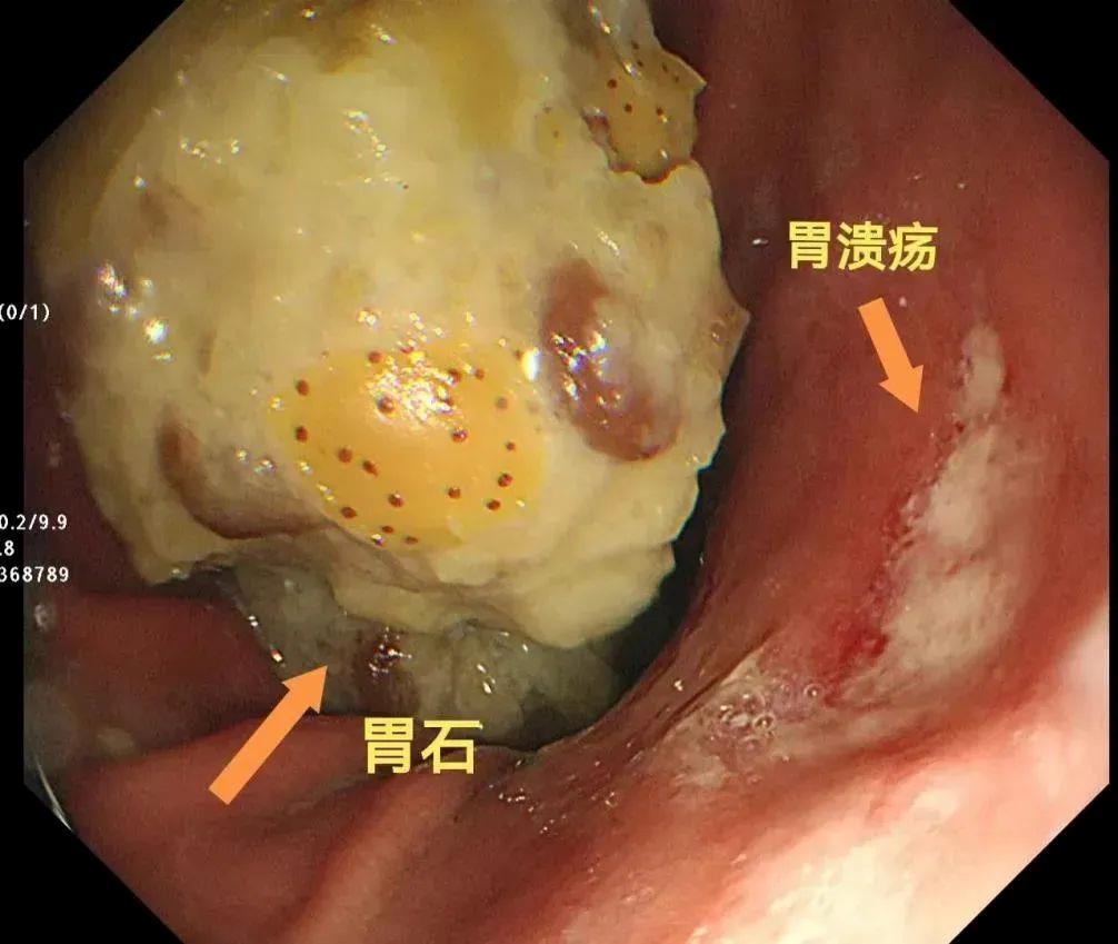 微博被转发会被提醒吗_大量奶粉怎么做简单美食_