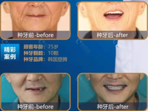成都牙科医院_成都医院牙科收费价目表_成都医院牙科可以刷医保吗