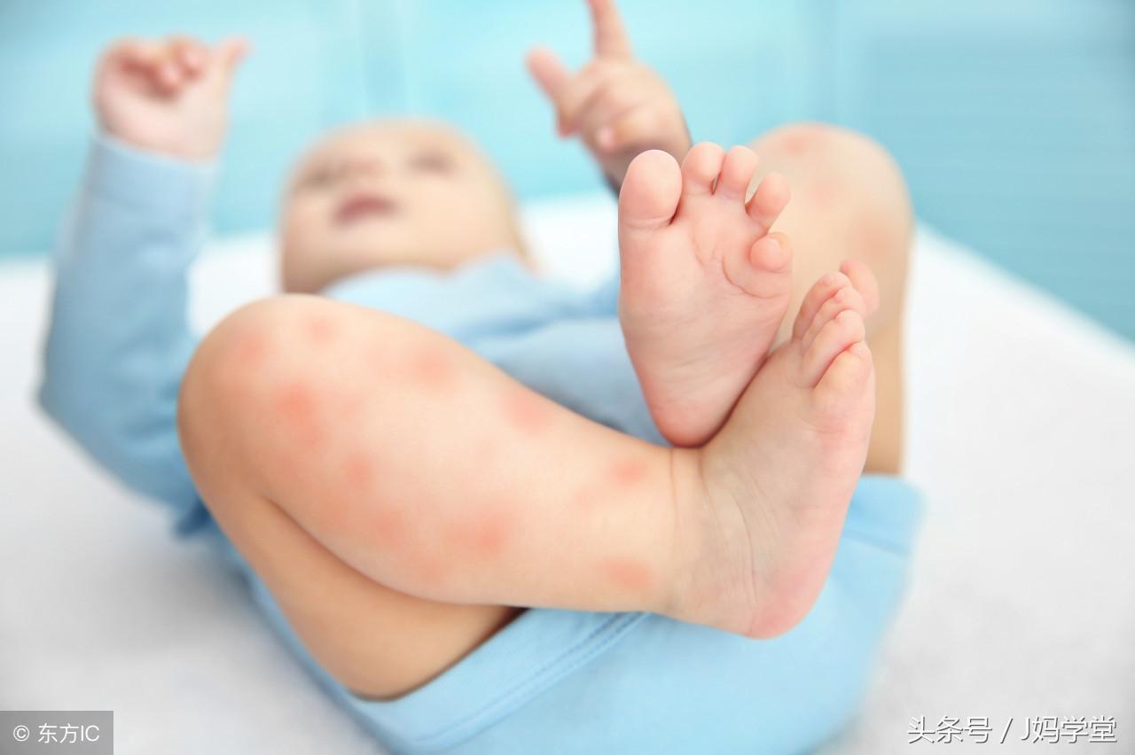 婴儿缺锌的原因有哪些？如何确认宝宝缺锌？(图4)