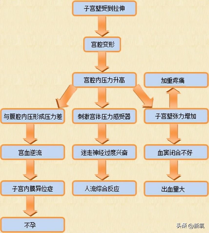 宫腔取胚术收费标准_宫腔取胚术是怎么样过程视频_宫腔取胚术是骗局吗