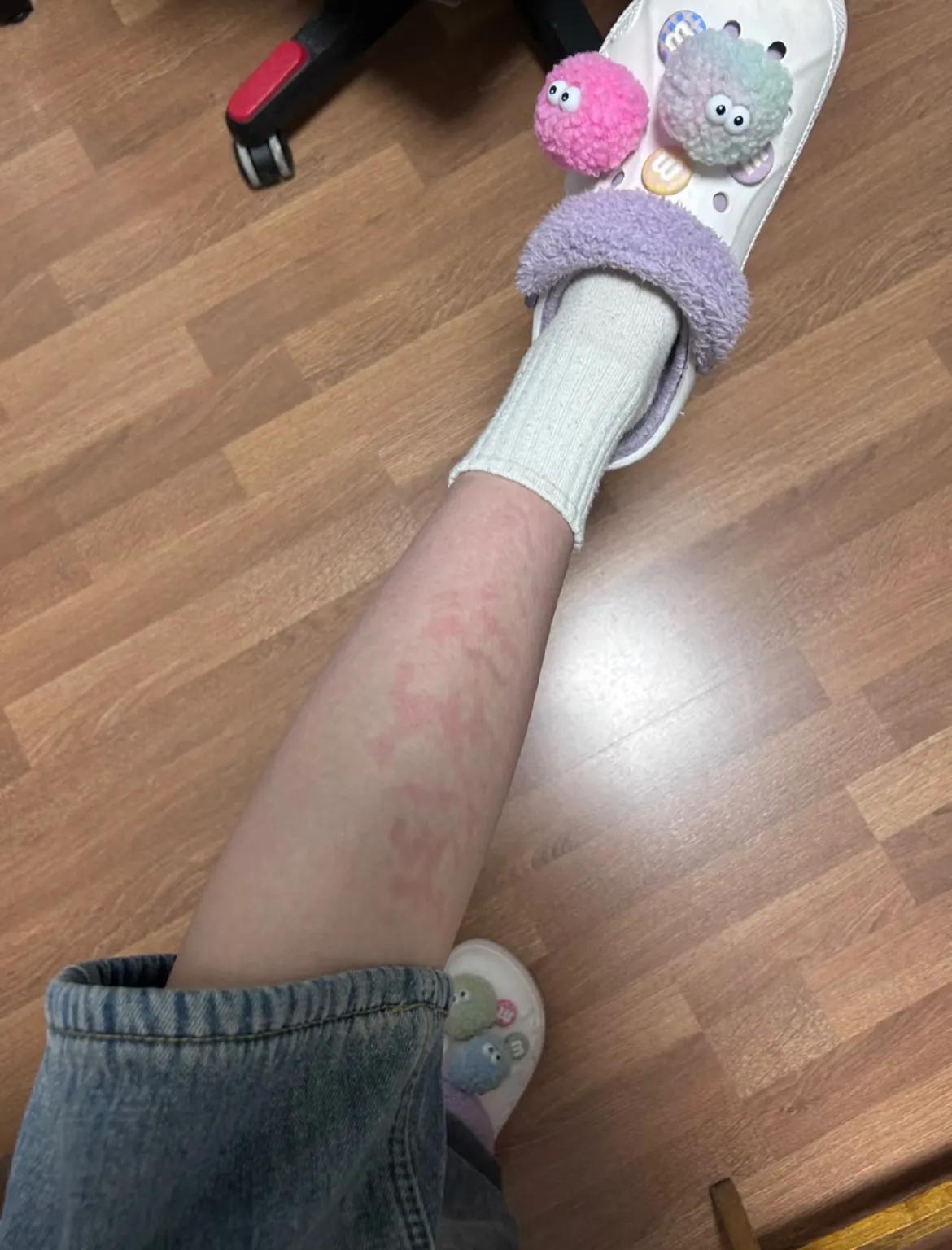 电热毯会烧坏吗_电热毯会不会造成触电事故视频_