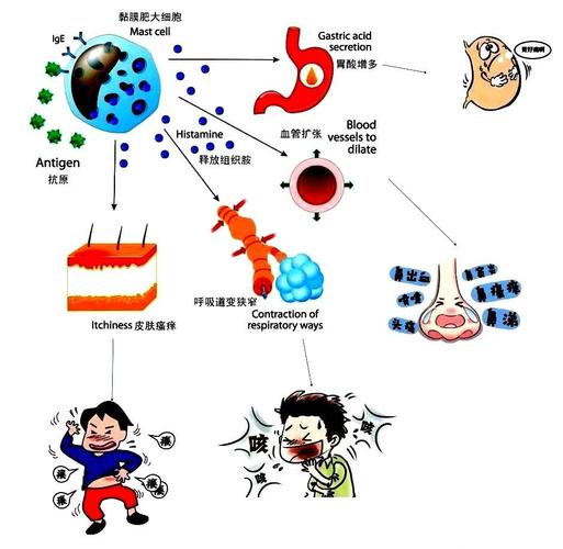 过敏是世界难题_全球过敏原情况_