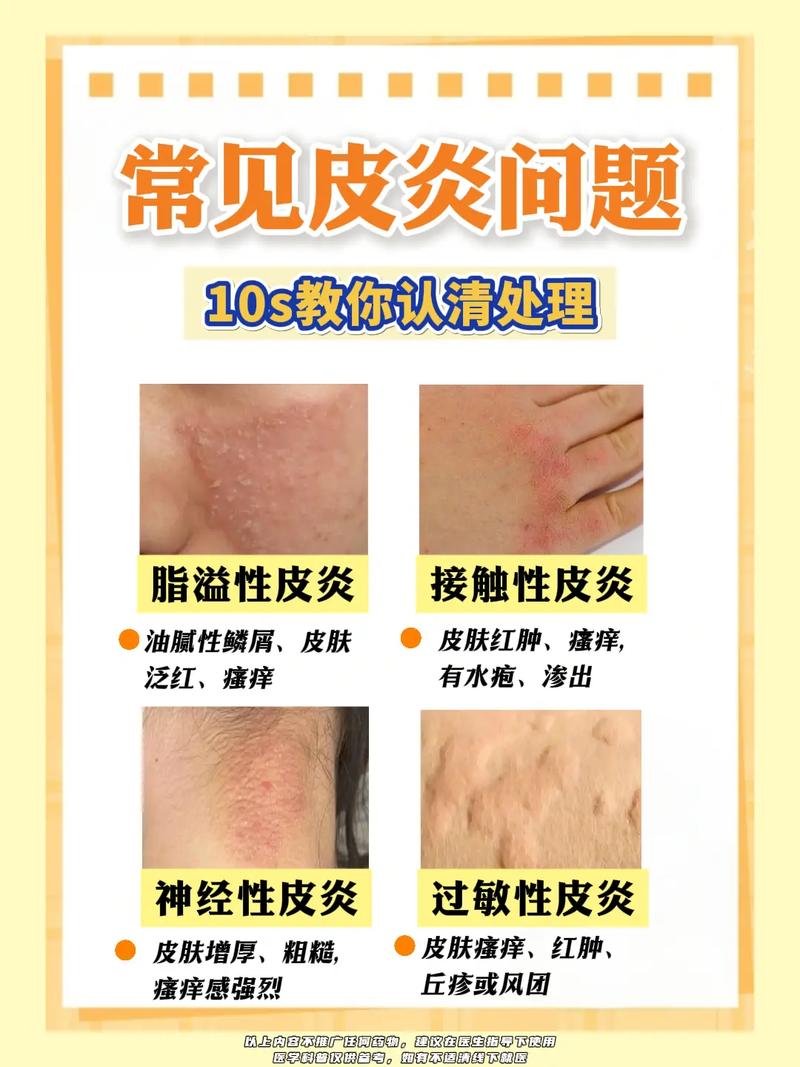 合肥治疗皮肤病医院_合肥治疗皮肤病_合肥治疗皮肤病费用