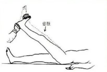 芜湖做腰椎间盘突出症手术那个医院最好_腰椎间盘突出症初步判断_腰痛测试动作